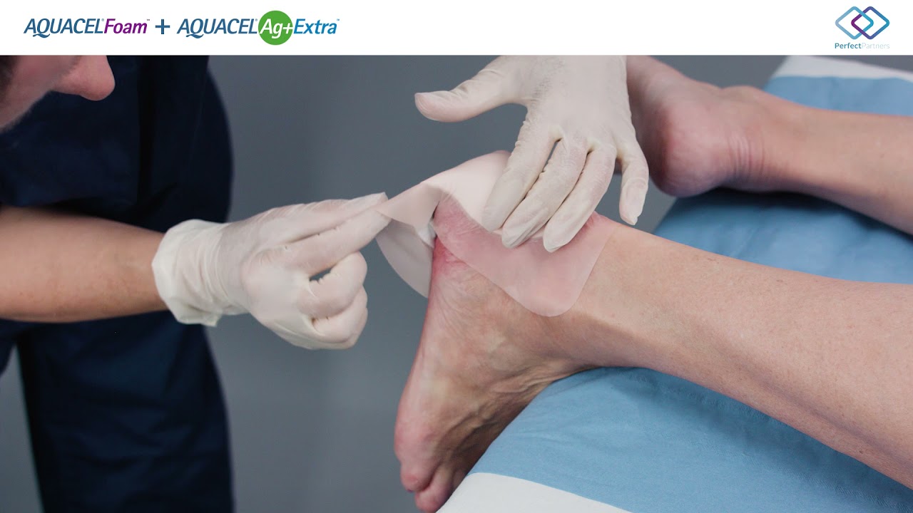 Aquacel AG+: Tu solución de salud innovadora 8 Aquacel AG+: Tu solución de salud innovadora