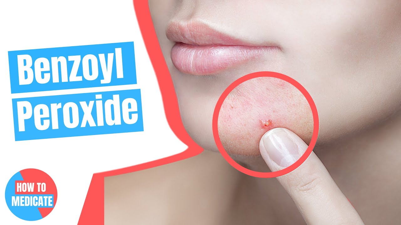 Todo lo que debes saber sobre Benzac AC 10 para el cuidado de la piel