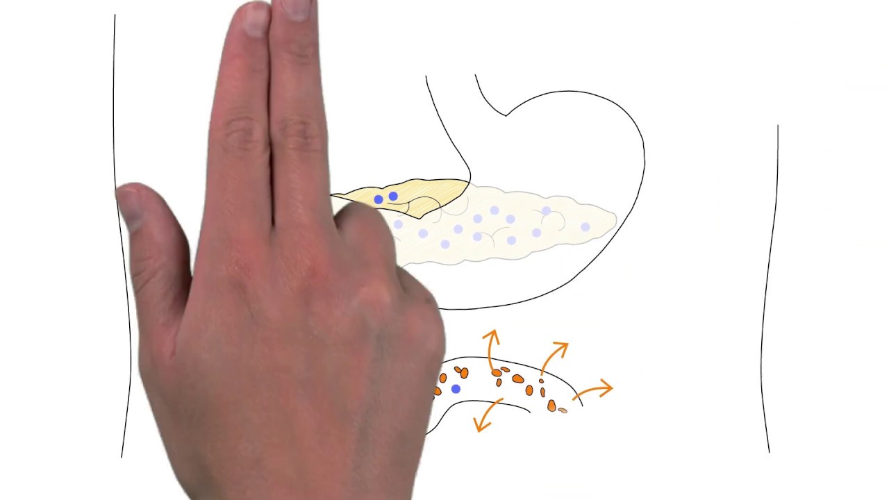 Los beneficios de la bilis de buey para la salud 8 Los beneficios de la bilis de buey para la salud