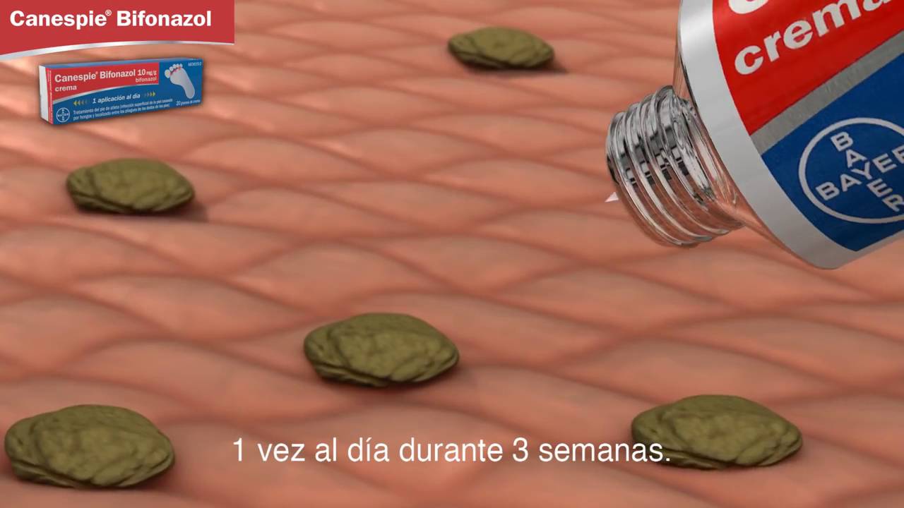 Canespie: El mejor tratamiento para hongos 3 Canespie: El mejor tratamiento para hongos