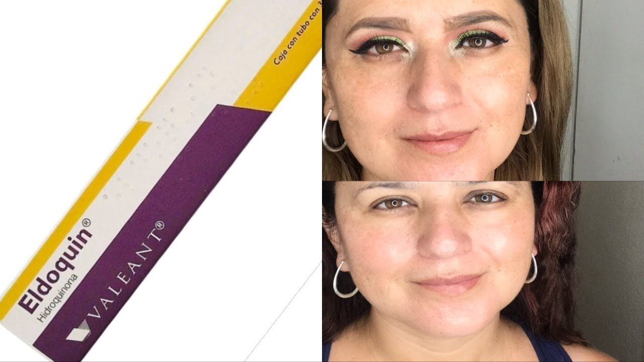 Descubre los beneficios deldoquin 4 para tu piel