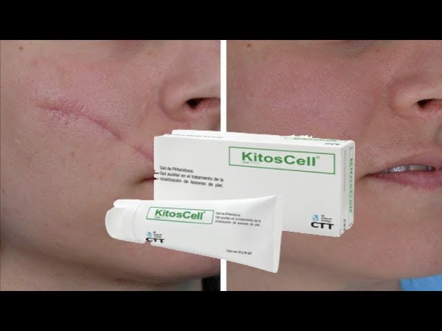 Descubre los beneficios y usos del Kitoscell Gel