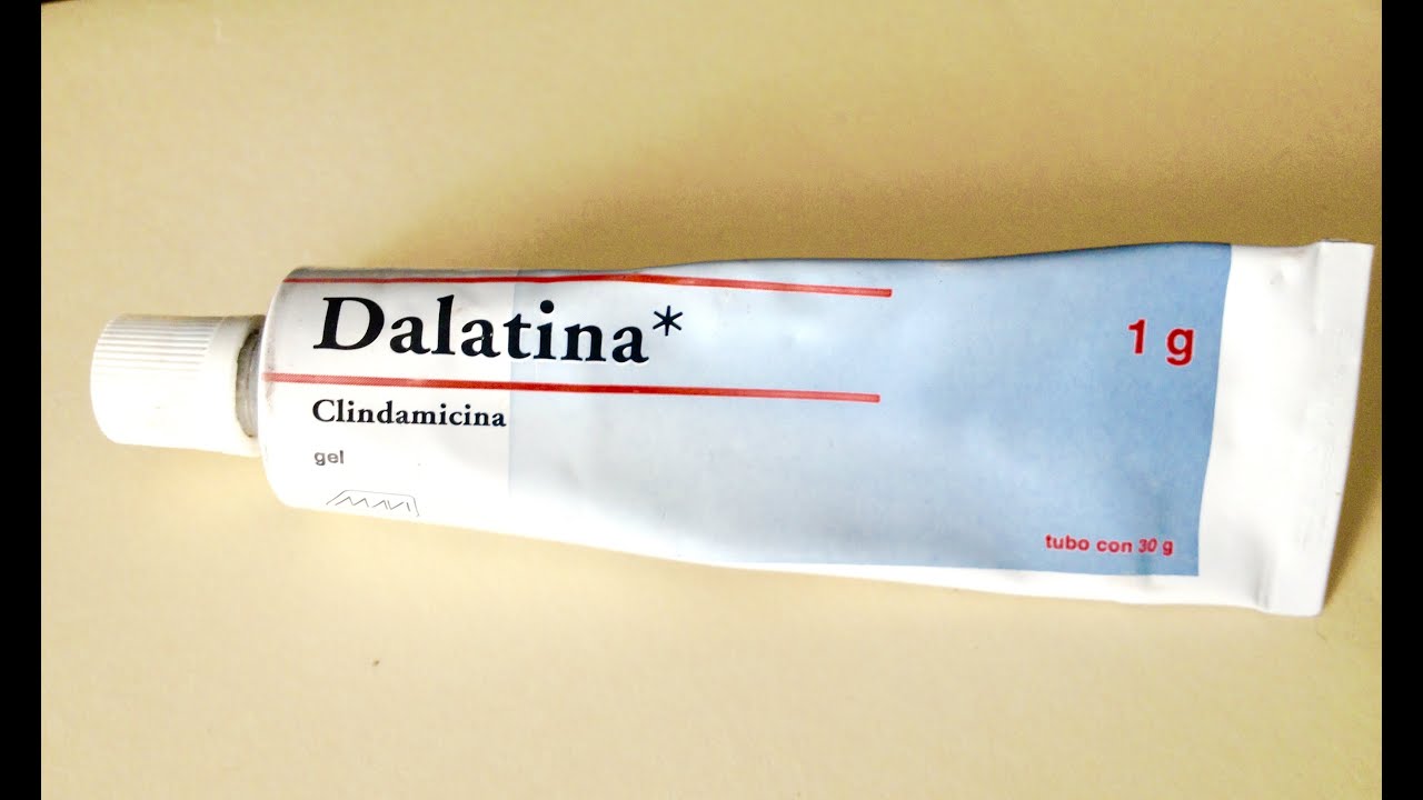 6 tips para aliviar el dolor con gel